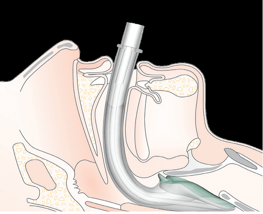 I - GEL O2 RESUSCITATION PACK - Sands Canada