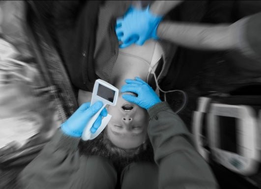 I - view Video Laryngoscope Disposable - Sands Canada