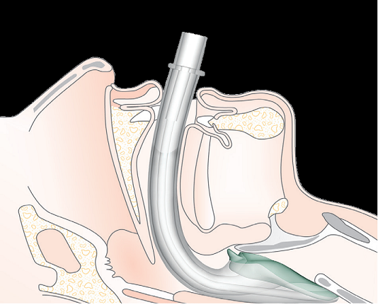 I-GEL O2 SINGLE USE SUPRAGLOTTIC AIRWAY 