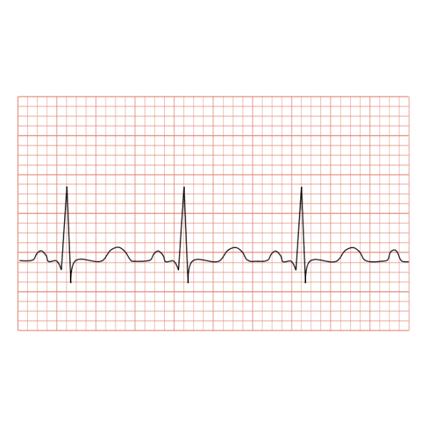 LP12 / 15 12 Lead ECG Paper - 3/PKG (Copy) - Sands Canada